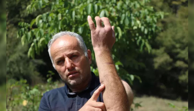 Babası gibi ayı saldırısına uğradı… Parmağı koptu…